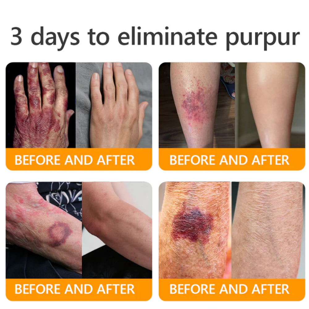 PUROSA® Bee Venom Wrinkle-Firming Multi-purpose Cream 🔥 LAST DAY 80% OFF