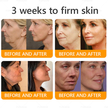 PUROSA® Bee Venom Multi-Action Cream 🐝🔥 LAST DAY — 80% OFF!A powerful anti-aging solution that targets:Deep wrinkles\Fine lines\Sagging skin\Uneven tone\Dryness